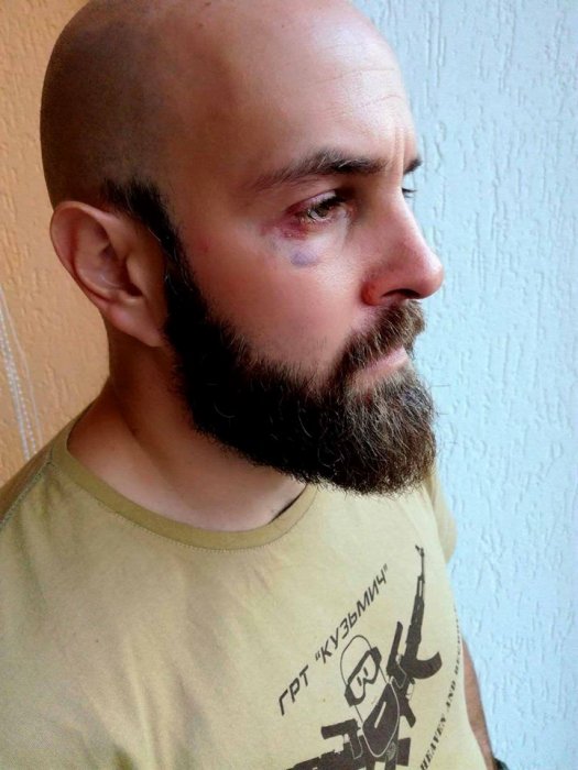 Хто й чому напав у Житомирі на Антона Фарба? 