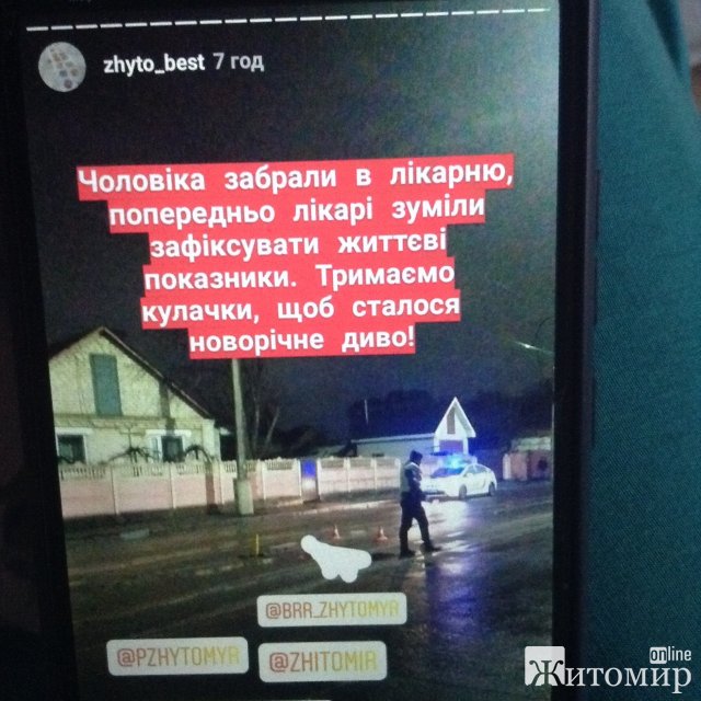 На Східній в Житомирі в чоловіка влучив феєрверк