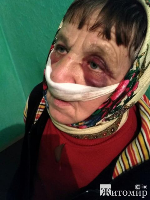У селі Житомирської області через коня бізнесмен побив подружжя пенсіонерів. ФОТО