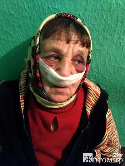 У селі Житомирської області через коня бізнесмен побив подружжя пенсіонерів. ФОТО