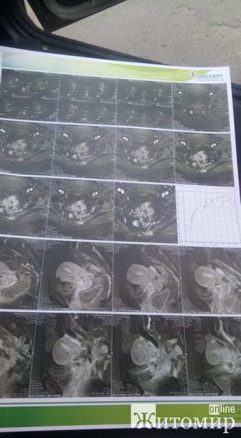 Чоловік просить небайдужих жителів Житомирщини допомогти його дружині