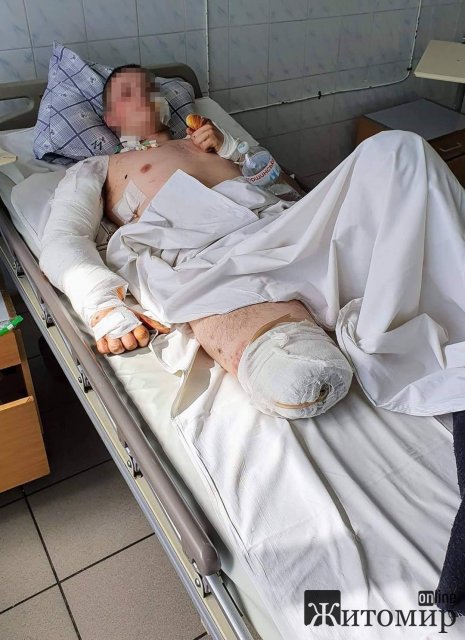  В яких умовах знаходяться чоловіки в тубвідділенні військового шпиталю. ФОТО