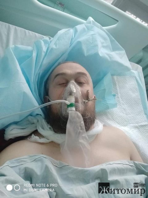 В Житомирской области мужчина обрезал деревья на кладбище и упал: сломаны рёбра и лопнуло легкое. ФОТО