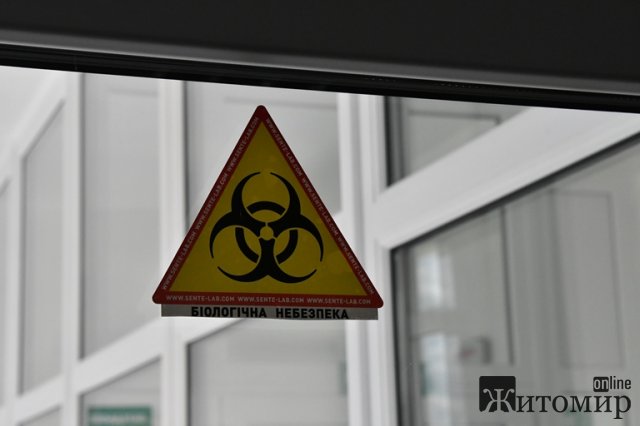  У спецлабораторії в обласній лікарні Житомира робитимуть до 35 аналізів на коронавірус на добу. ФОТО