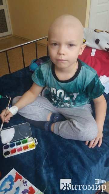 Маленькому мальчику с Житомира срочно нужны доноры 