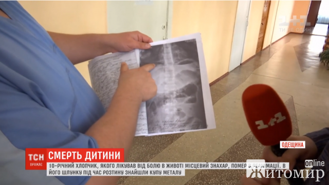  Наглотался гаек, болтов: под Одессой умер ребенок, которого лечила знахарка