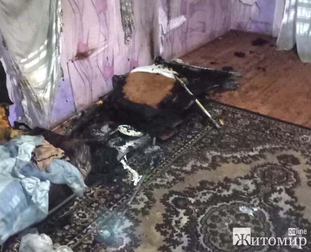У селі Житомирської області загорівся обігрівач, опіки отримала однорічна дитина. ФОТО