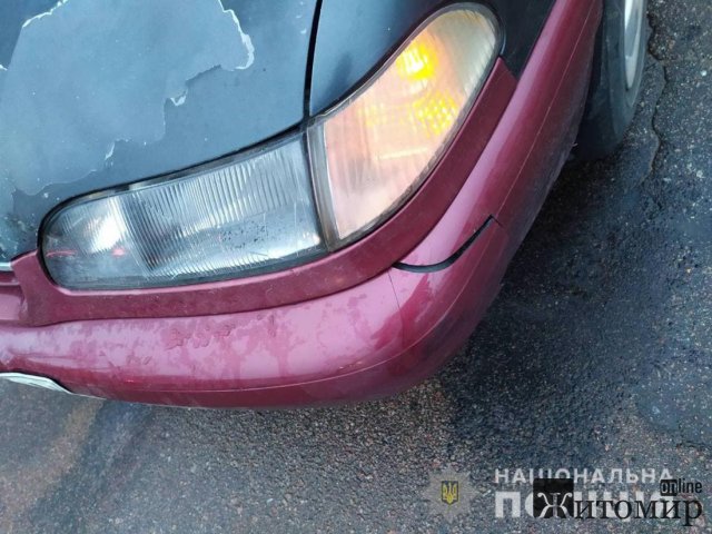 У Коростені Hyundai збив жінку, потерпілу госпіталізували до лікарні. ФОТО