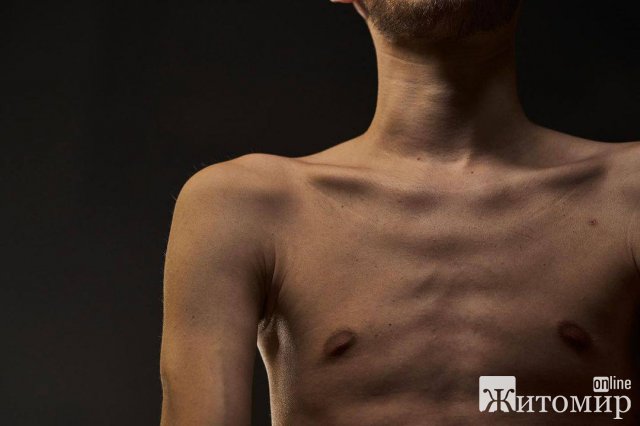 Перша фотосесія після полону Дмитра Козацького з Малина