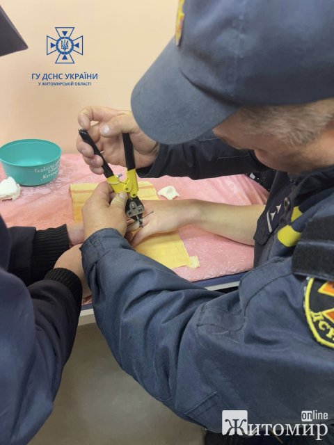 На Житомирщині хлопець приміряв каблучку товариша, а зняти не зміг