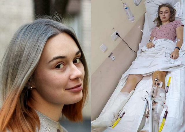 «Не можу звикнути до протеза»: винесено вирок майору, який на території військової частини п’яним наїхав на трьох курсанток «Не можу звикнути до протеза»: винесено вирок майору, який на території військової частини п’яним наїхав на трьох курсанток