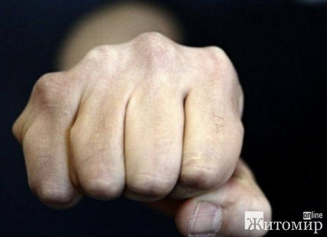 У Бердичівському районі місцева мешканка скаржиться на батьків, які побили чужих дітей під час святкування шкільного випуску У Бердичівському районі місцева мешканка скаржиться на батьків, які побили чужих дітей під час святкування шкільного випуску