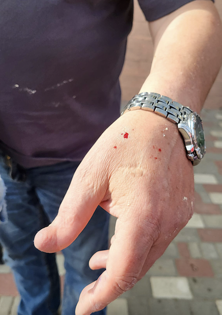 В Одесі рідкісна змія покусала директора зоопарку В Одесі рідкісна змія покусала директора зоопарку