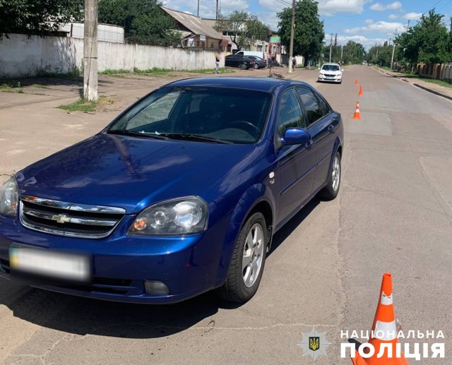 У Житомирі зіштовхнулись водій Chevrolet та велосипедист: керманич двоколісника отримав травми