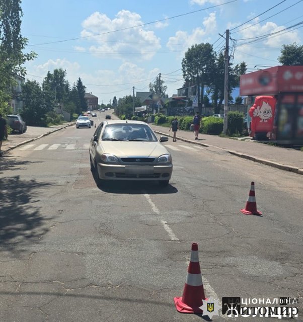 У селищі Житомирської області ЗАЗ наїхав на чоловіка, який переходив дорогу. ФОТО