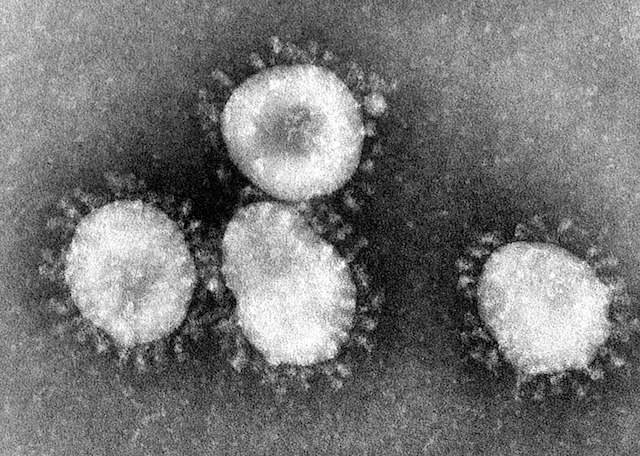 1586946650_800px-coronaviruses_004_lores