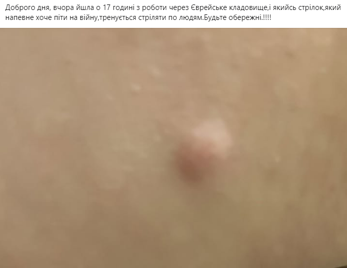 У Бердичеві майже в центрі міста стріляють по людях - Події. Джерело: Zhitomir-OnLine У Бердичеві майже в центрі міста стріляють по людях - фото №