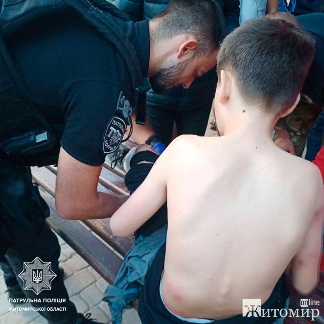 У Житомирі собаки покусали 12-річного хлопця. ФОТО У Житомирі собаки покусали 12-річного хлопця. ФОТО
