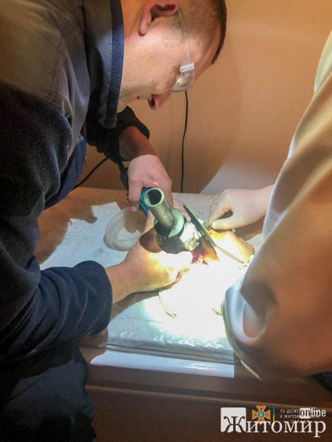 Житомирські рятувальники зрізали обойму підшипника з пальця 14-річного хлопця. ФОТО Житомирські рятувальники зрізали обойму підшипника з пальця 14-річного хлопця. ФОТО