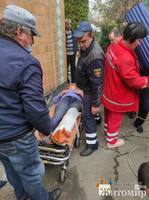 У Новограді-Волинському жінка впала у підвал та зламала ногу. ФОТО У Новограді-Волинському жінка впала у підвал та зламала ногу. ФОТО