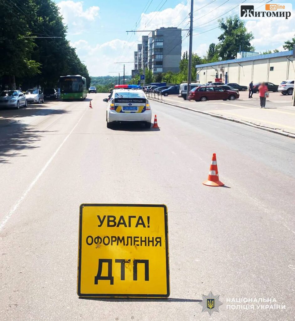 У Житомирі пенсіонерка потрапила до лікарні після наїзду автомобіля - Події. Джерело: Zhitomir-OnLine У Житомирі пенсіонерка потрапила до лікарні після наїзду автомобіля - фото №