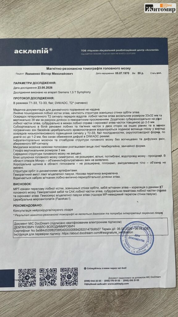11 переломів черепа, а у справі — свідок: родина з Радомишля вимагає розслідування ДТП - фото №2