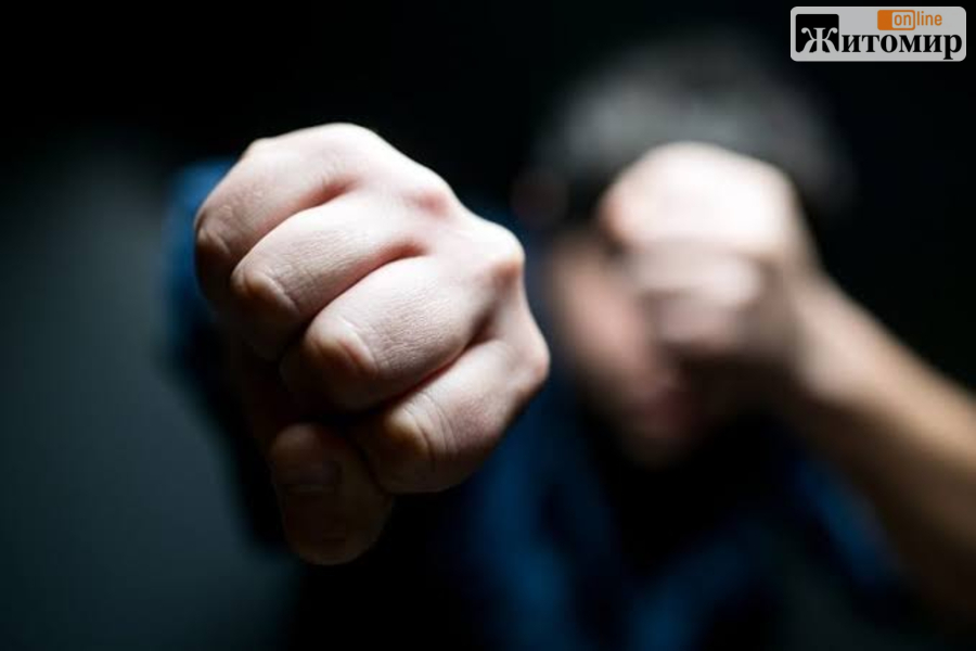 Жителя Олевської громади підозрюють у смертельному побитті дружини