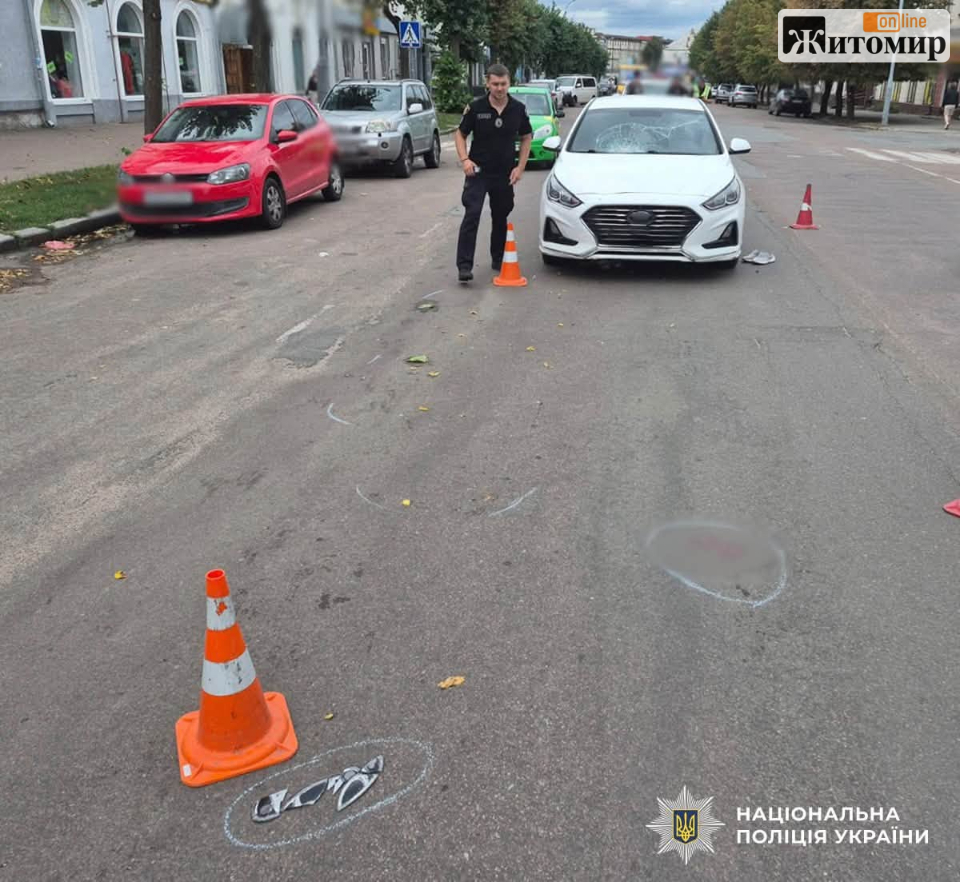 У Бердичеві юнак на Hyundai збив літнього чоловік: потерпілий в реанімації