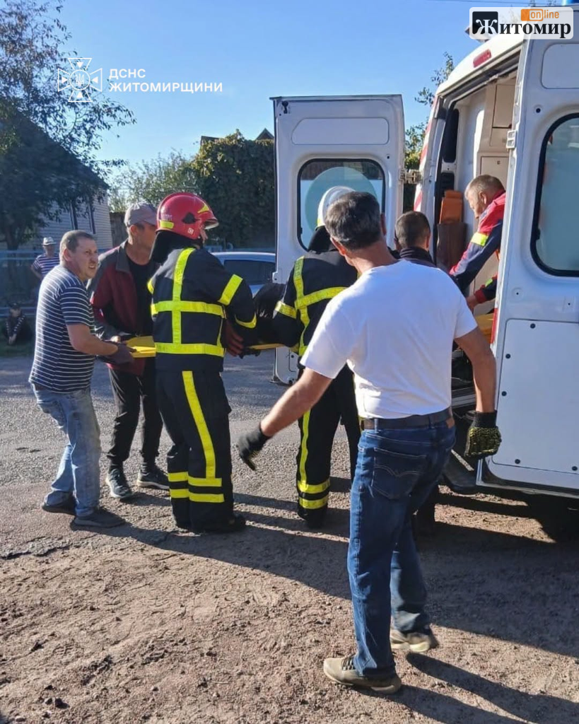 Притисло мотоблоком – у селі Житомирського району рятувальники деблокували чоловіка